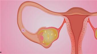 正常子宫视频,透过视频探索女性生殖奇迹